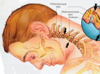 Шейный остеохондроз и артериальное давление, может ли шейный остеохондроз повышать давление шейный остеохондроз и артериальное давление, может ли шейный остеохондроз повышать давление
