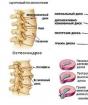 Cvičebná terapia pre osteochondrózu krčnej chrbtice: odporúčania pre cvičenia, kontraindikácie pre výkon