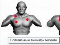पीठ की मांसपेशियों में दर्द के कारण और उपचार