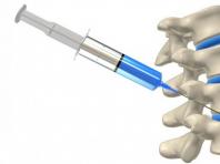 How to give injections for osteochondrosis of the cervical spine?