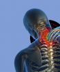 Súbor cvičení pre krk na osteochondrózu krčnej chrbtice: popis a video - pokyny